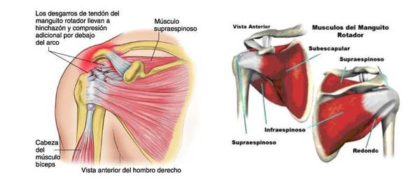 Dor no Ombro: Ilustração do manguito rotator