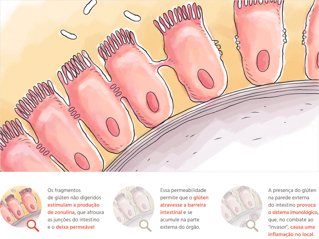 Celíaca - Entenda com a Doença Age