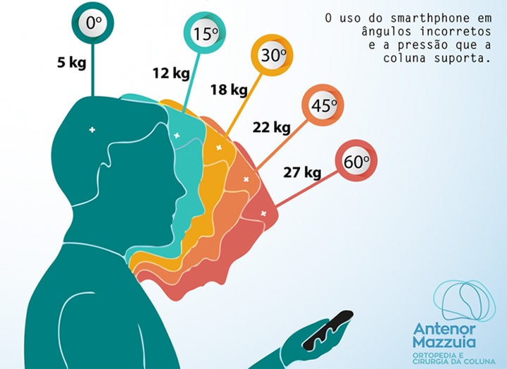 Uso do celular em excesso pode causar lesões em tenistas